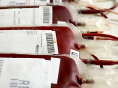 Малыш, которому 2 недели назад сделали переливание ВИЧ-инфицированной крови, пока не заразился Малыш, которому 2 недели назад сделали переливание ВИЧ-инфицированной крови, пока не заразился